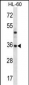 PSMB8 Antibody (N-term)